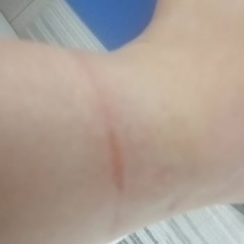 Aldığım Bot İlk Kullanımda Yaraladı, İade Talebim Reddedildi