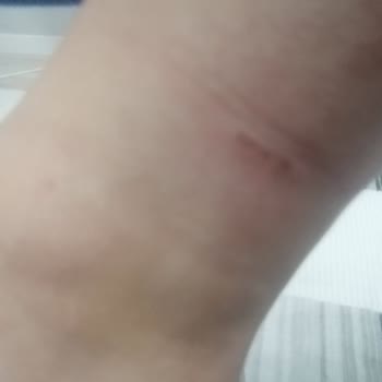 Aldığım Bot İlk Kullanımda Yaraladı, İade Talebim Reddedildi