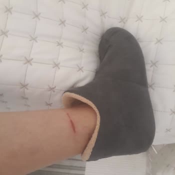 Aldığım Bot İlk Kullanımda Yaraladı, İade Talebim Reddedildi