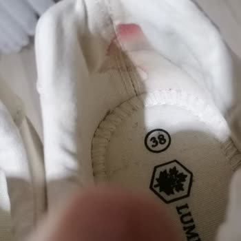 İlk Kullanımda Ayağımı Yaralayan Sneaker İçin İade Talebi