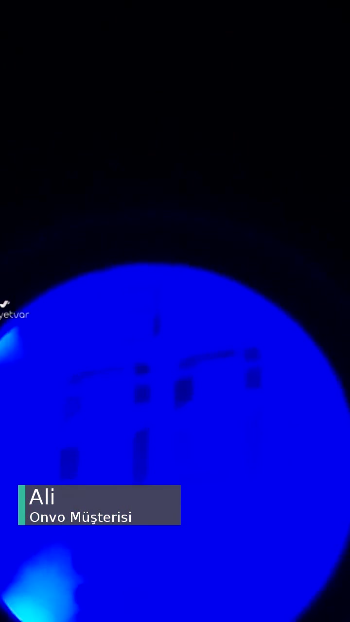 Bana Onvo Yardım Etsin videonun kapak resmi