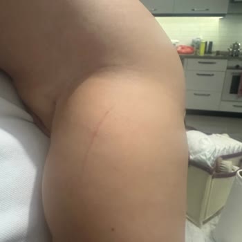 Yeni Ambalajlı Bebek Bezi Ciddi Cilt Sorunlarına Yol Açtı