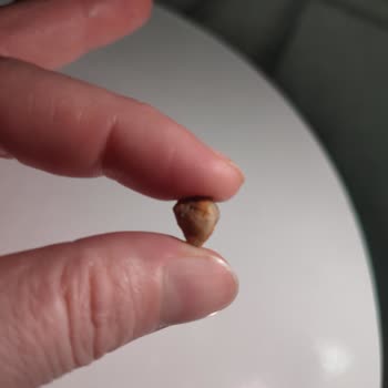 Kuruyemişten Çıkan Taş Dişimi Kırıyordu Çocuklar İçin Tehlikeli