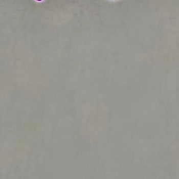 Yeni Alınan Samsung S25 Ultra'nın Kamerasında Mor Leke Sorunu Ve Yetersiz Müşteri Hizmeti