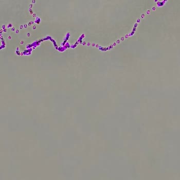 Yeni Alınan Samsung S25 Ultra'nın Kamerasında Mor Leke Sorunu Ve Yetersiz Müşteri Hizmeti