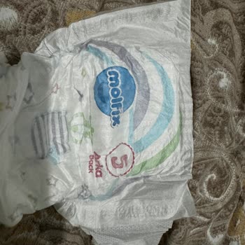 Molfix Bebek Bezinde Hatalı Ve Eksik Yapıştırma Sorunu Yaşadım