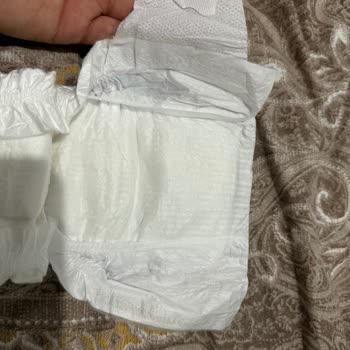 Molfix Bebek Bezinde Hatalı Ve Eksik Yapıştırma Sorunu Yaşadım