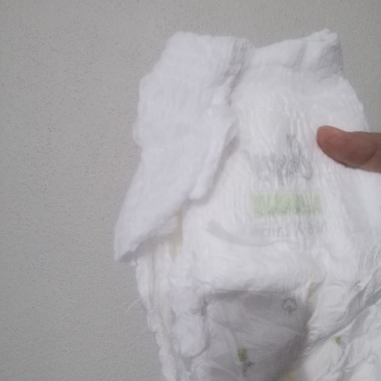 Sleepy Külot Bez Paketi İçinden Yırtık Ürün Çıktı, Mağduriyet Yaşadım