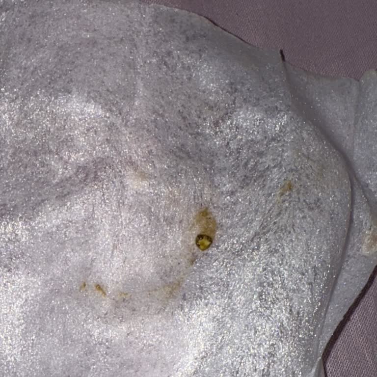 Reyhan Pastanesi Çikolatanın İçinden Taş Çıktı Dişim Acıdı