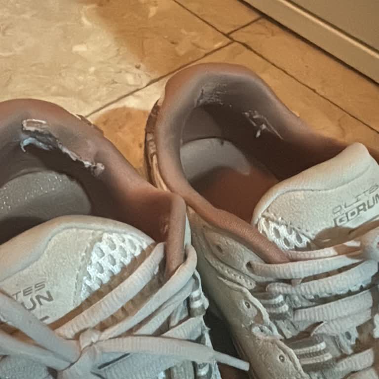 Az Kullanımla Skechers Ayakkabıda Erken Yırtık Ve Garanti Reddi Mağduriyeti