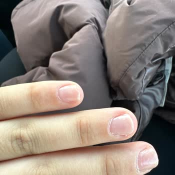 Protez Tırnak Uygulaması Sonrası Ciddi Sağlık Sorunları Ve Memnuniyetsizlik