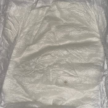 Bebek Bezinde Sararma Ve Yabancı Nesneler Nedeniyle Hijyen Endişesi