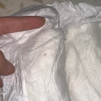 Bebek Bezinde Sararma Ve Yabancı Nesneler Nedeniyle Hijyen Endişesi