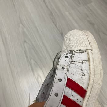 Adidas Superstar Ayakkabıda Renk Atması Ve Deri Soyulması Hayal Kırıklığı