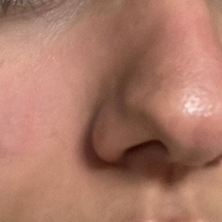 Aldığım Fondöten Cildimde Alerjik Reaksiyona Sebep Oldu, İade Talep Ediyorum