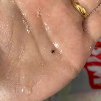 Bebek Ürününde Böcek Şoku: Sağlık Güvenliği Endişesi