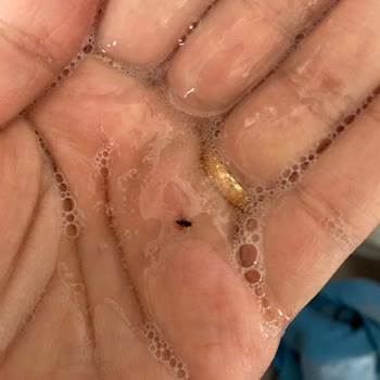 Bebek Ürününde Böcek Şoku: Sağlık Güvenliği Endişesi