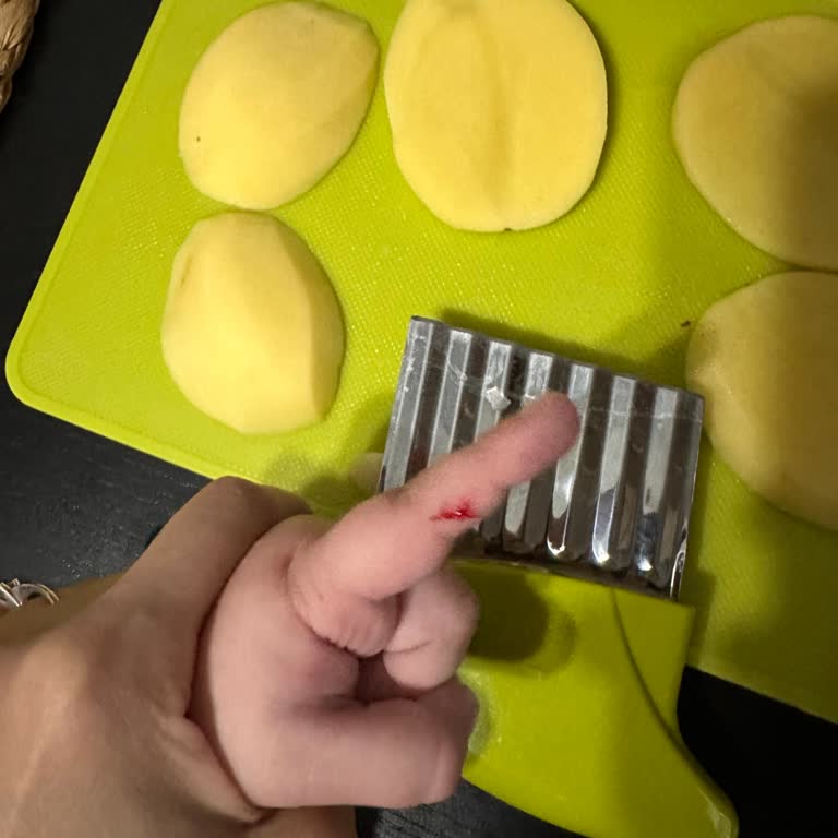 Çocuk Güvenliği Tehlikede: El Kesilmeyen Set Parmak Kesti!