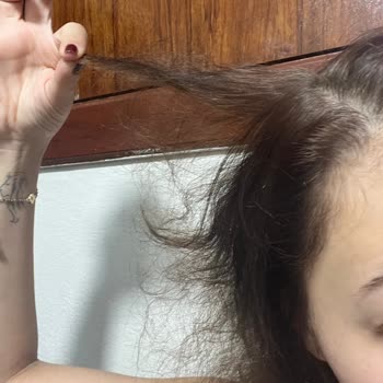 Yanlış Saç Boyası Yüzünden Saçlarım Yandı Migros Masrafımı Karşılamıyor