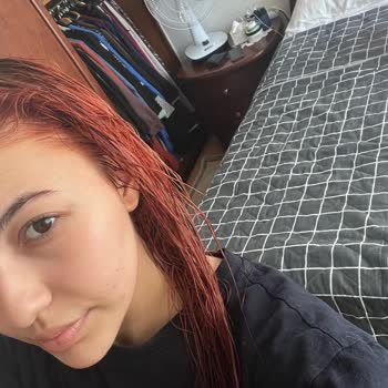 Yanlış Saç Boyası Yüzünden Saçlarım Yandı Migros Masrafımı Karşılamıyor