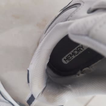Kısa Sürede Deforme Olan Skechers Ayakkabı İçin Değişim Talebim Reddedildi