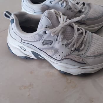 Kısa Sürede Deforme Olan Skechers Ayakkabı İçin Değişim Talebim Reddedildi