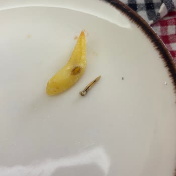 Dondurulmuş Patates İçinden Yabancı Madde Çıkması Ve Açıklama Talebi