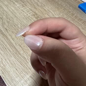 Protez Tırnak İşleminden Sonra Kısa Sürede Sorun Ve İlgisiz Hizmet