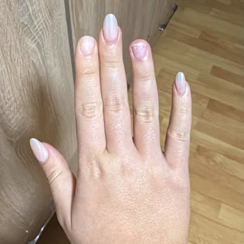 Protez Tırnak İşleminden Sonra Kısa Sürede Sorun Ve İlgisiz Hizmet