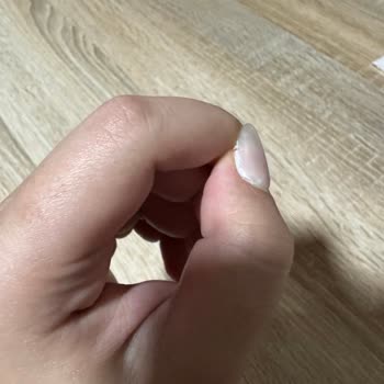 Protez Tırnak İşleminden Sonra Kısa Sürede Sorun Ve İlgisiz Hizmet