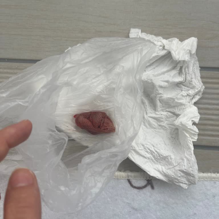 Çorum Özel Hastanesi Doğum Sonrası Gazlı Bez İhmali ve Hastane Yönetiminin İlgisizliği