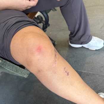 Urla Bamboo AVM’de Kaygan Zeminde Düşerek Ciddi Şekilde Yaralandım Destek Alamadım