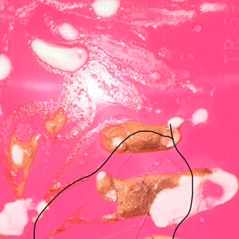 Golf Dondurma Dondurmanın İçinden Kıl Çıktı: Hijyen Ve Sağlık Riski!