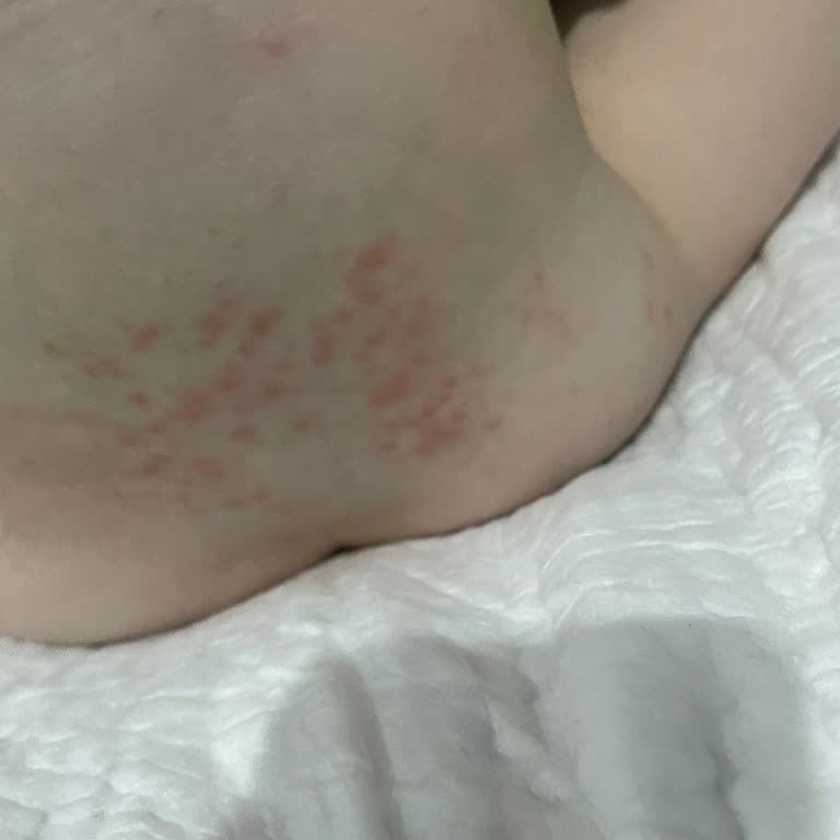 Prima Bebek Bezi Alerji Ve Sızdırma Sorunu Yaşattı