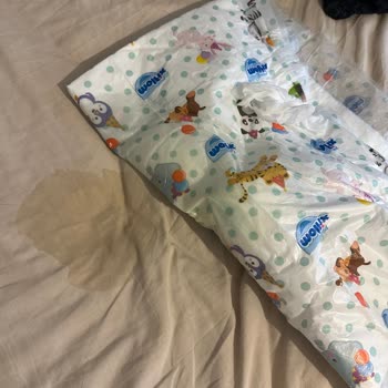 Molfix Bakım Örtüsü Sıvı Geçiriyor, Memnun Kalmadık