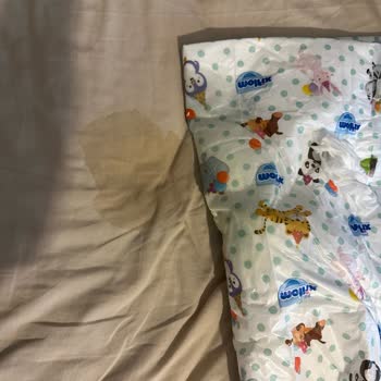 Molfix Bakım Örtüsü Sıvı Geçiriyor, Memnun Kalmadık