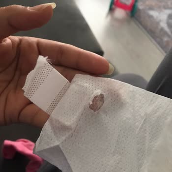 Molfix 6 Numara Bezlerde Sürekli Bant Sorunu Ve Sızıntı Problemi