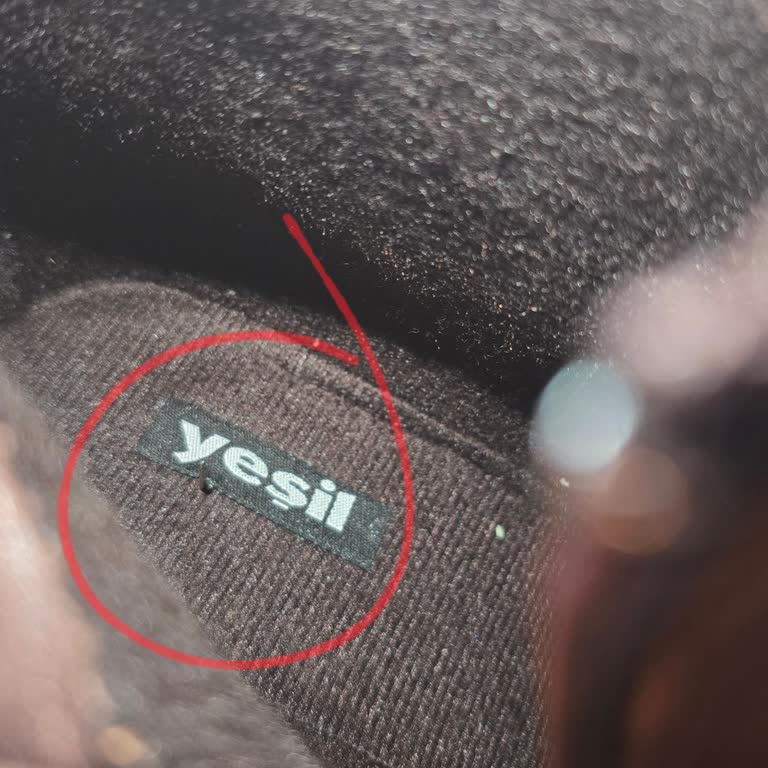 Bot İçindeki Çivi Nedeniyle Yaralandım, Mağduriyetimin Giderilmesini İstiyorum