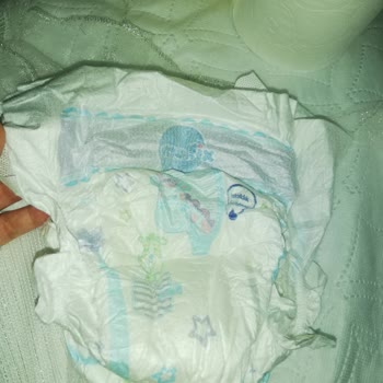 Molfix 5 Numara Bebek Bezinde Sürekli Sızdırma Ve Kalite Sorunu