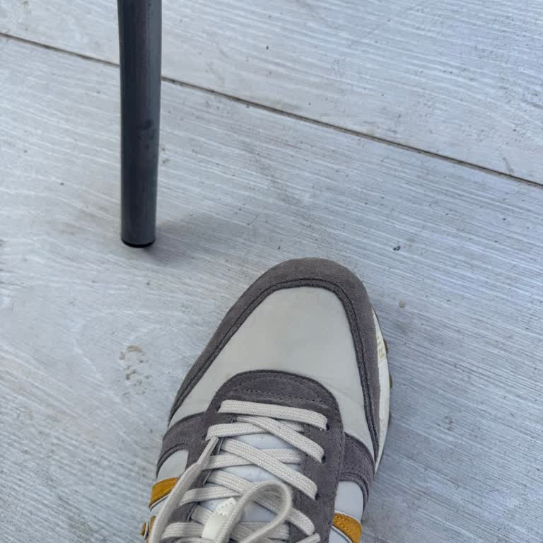 Kısa Sürede Sararan Ayakkabı İçin Çözüm Bekliyorum