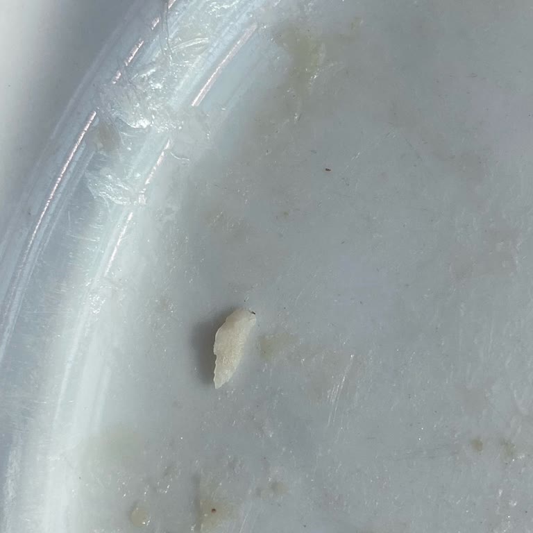 IKEA Mamak'ta Köfte Menüden Çıkan Kemik Parçası Sağlığımı Tehdit Etti