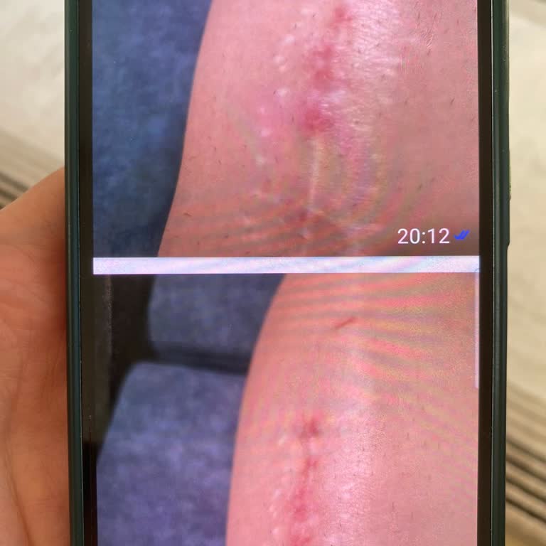 Tedavi Sürecinde Artan Ağrılar Ve İlgisizlik Nedeniyle Memnuniyetsizlik