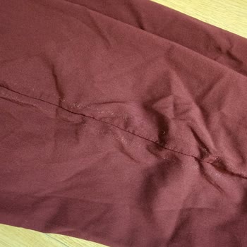 Stradivarius Elbise Deformesi Sonrası Fatura Ve Destek Sorunları Yaşadım