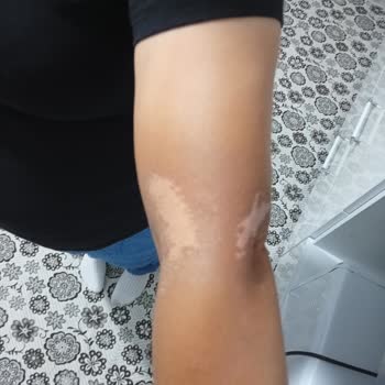 Korkmaz Su Isıtıcısı Alt Kısmı Yanıyor Güvenlik Riski Devam Ediyor