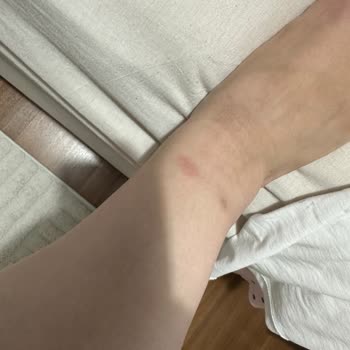 Zara Mağazasında İade Talebim Reddedildi Ve Kaba Davranışa Maruz Kaldım