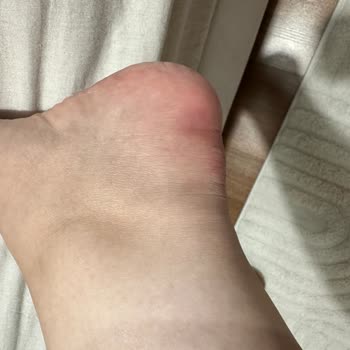 Zara Mağazasında İade Talebim Reddedildi Ve Kaba Davranışa Maruz Kaldım