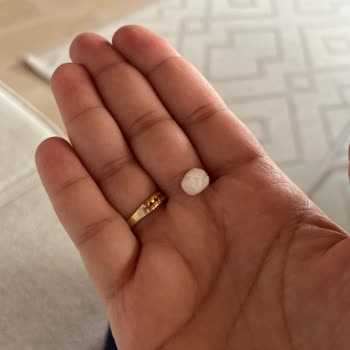 Bebek Bezinden Çıkan Plastik Parça Bebeğimin Sağlığını Riske Attı