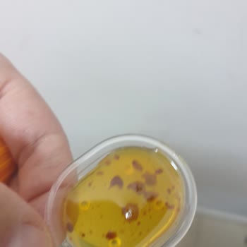 Aldığım Şurup Bozuk Çıktı Çocuğumda Sağlık Sorunu Yaşandı