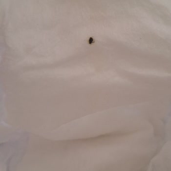 Bebek Bezi İçinde Böcek Ve Siyah Kalıntı Şoku!