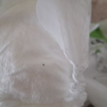 Bebek Bezi İçinde Böcek Ve Siyah Kalıntı Şoku!